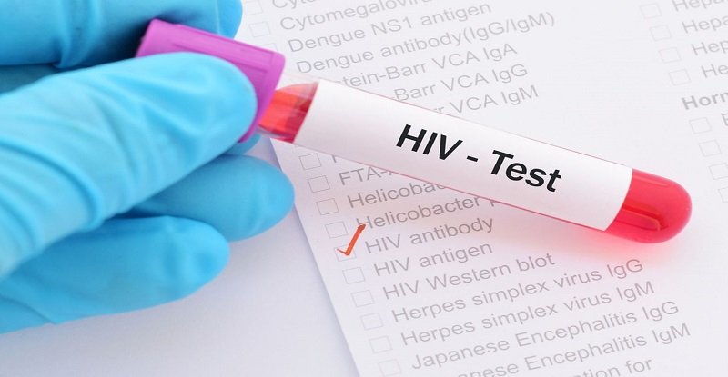 Vì sao cần xét nghiệm Hiv