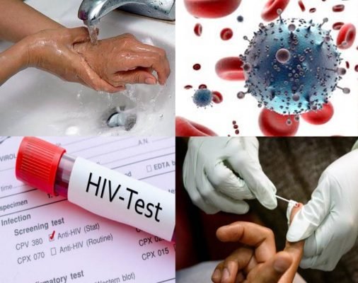 Phác đồ chuẩn xét nghiệm HIV