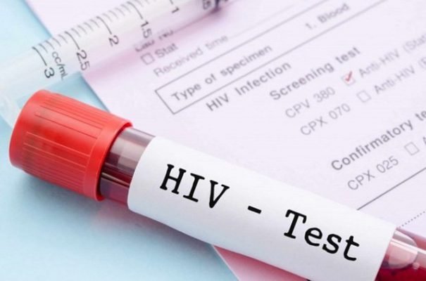 Xét Nghiệm HIV Miễn Phí 