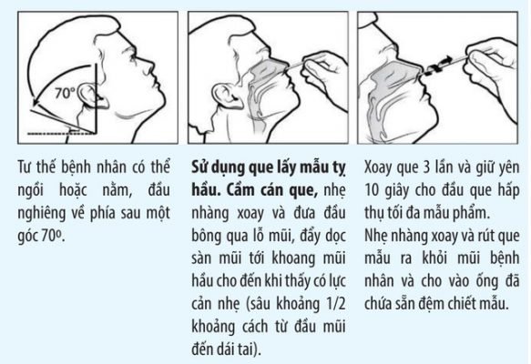 Test covid tại nhà dành cho bệnh nhân HIV Quận 4