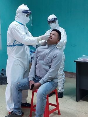 Khi nào cần xét nghiệm covid19 cho bệnh nhân HIV