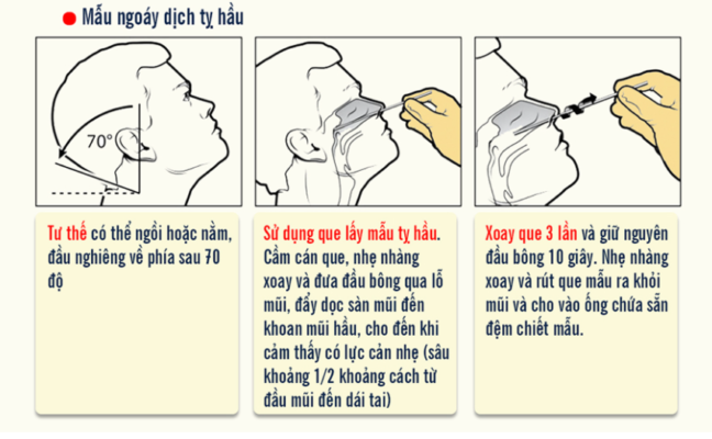 Kỹ thuật lấy mẫu tỵ hầu