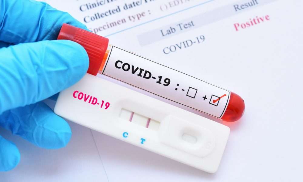 Xét nghiệm kháng thể Covid-19 tại nhà