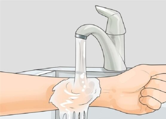 Rửa kỹ vết thương chảy máu bằng nước sạch