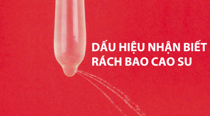 Quan hệ rách bao có bị nhiễm HIV không? 