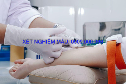 Xét nghiệm máu tại nhà Thành phố Thuận An
