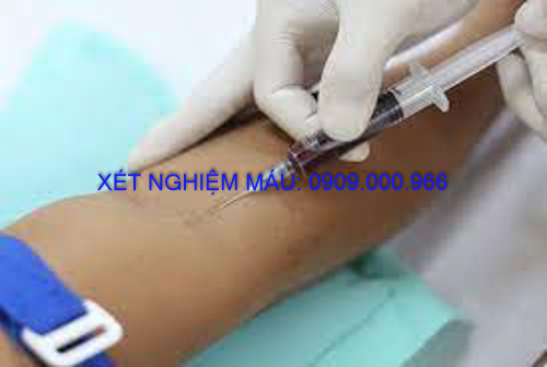 Xét nghiệm máu tại nhà Thành phố Tân Uyên