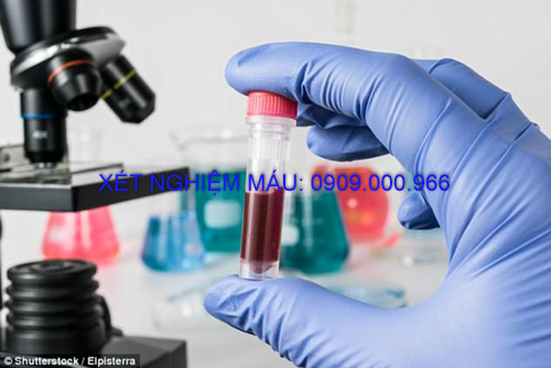 Xét nghiệm máu tại nhà Thị xã Bến Cát