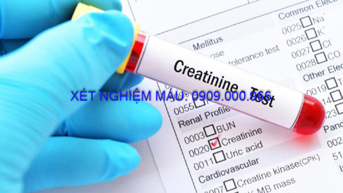 Xét nghiệm máu tại nhà huyện Bàu Bàng