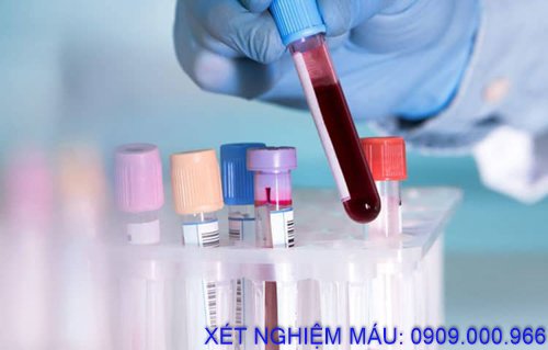 Xét nghiệm máu tận nơi phường An Phú