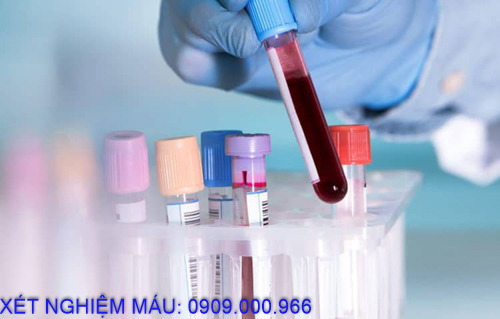 Xét nghiệm máu tại nhà phường An Phú