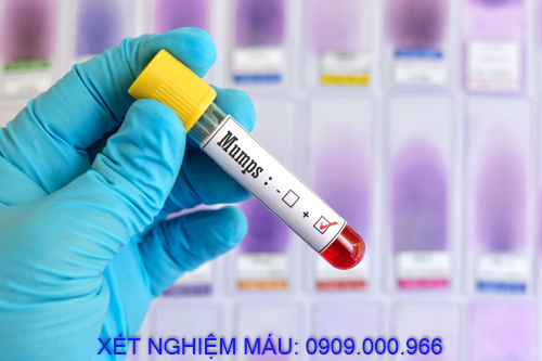 Xét nghiệm máu tận nơi phường Phú Tân