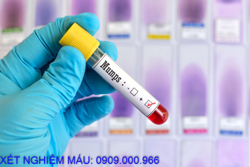 Xét nghiệm máu tại nhà phường Chánh Mỹ