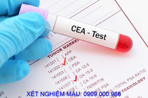 Xét nghiệm máu tận nơi phường Phú Thọ