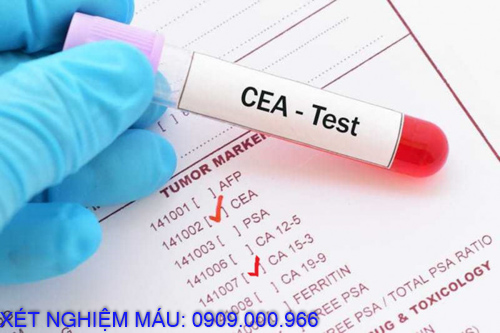 Xét nghiệm máu tại nhà phường Định Hòa