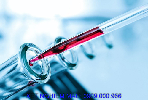 Xét nghiệm máu tận nơi phường Tân An