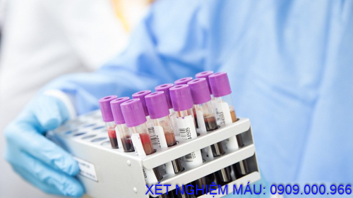 Xét nghiệm máu tận nơi phường Bình An