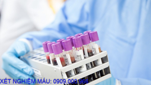 Xét nghiệm máu tại nhà phường Hiệp Thành