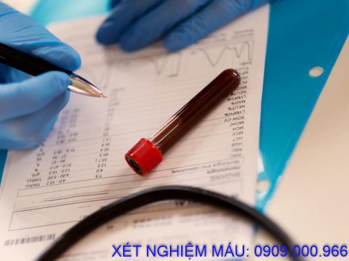 Xét nghiệm máu tận nơi phường Tân Đông Hiệp