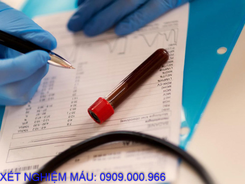 Xét nghiệm máu tại nhà phường Phú Mỹ