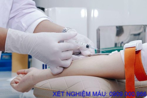 Xét nghiệm máu tận nơi phường Bình Chuẩn