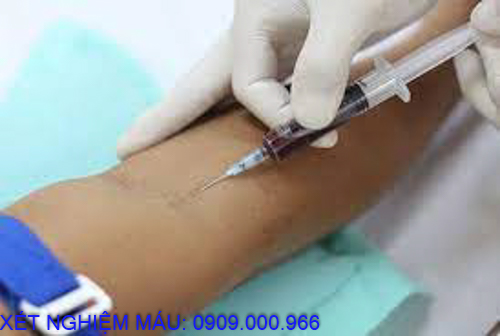 Xét nghiệm máu tại nhà phường Bình Hòa